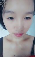 广西桂林不能生育的2