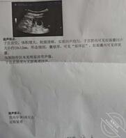 老婆怀孕了，这段时间操不了了，不知道孩子是在座的哪一位的。0
