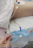 女病人手术后回病房走光0