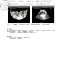 做了四次人流的母狗，做爱从来不带套，怀孕就让她自己去打掉2