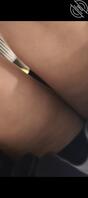 扶梯抄底2