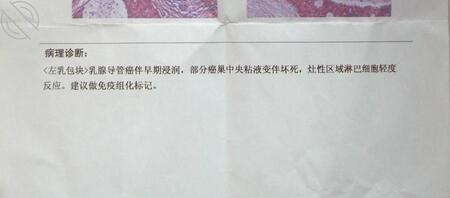 骚妈乳腺出问题了，要去医院割掉一个奶子0