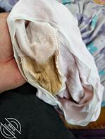 我妹好像被干出病了，逼里有分泌物把内裤都搞变色了还闻着味道好骚